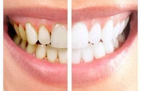 Белые зубки за 14 дней! Уникальное средство от P&G